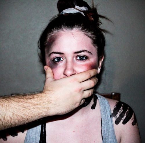 woman with bruises in her face with her mouth covered by a hand